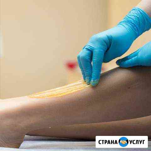 Эпиляция Владикавказ