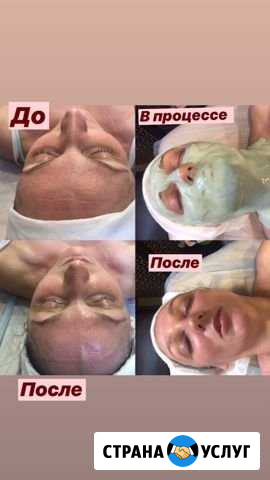 Услуги косметолога Псков - изображение 1