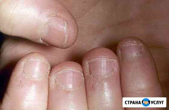 Наращивание и покрытие ногтей Новосибирск