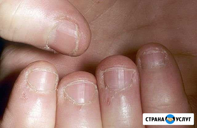 Наращивание и покрытие ногтей Новосибирск - изображение 1