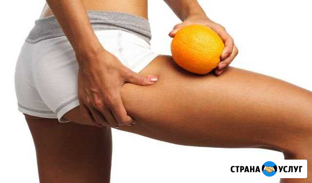 Антицеллюлитный массаж Нижний Новгород - изображение 1