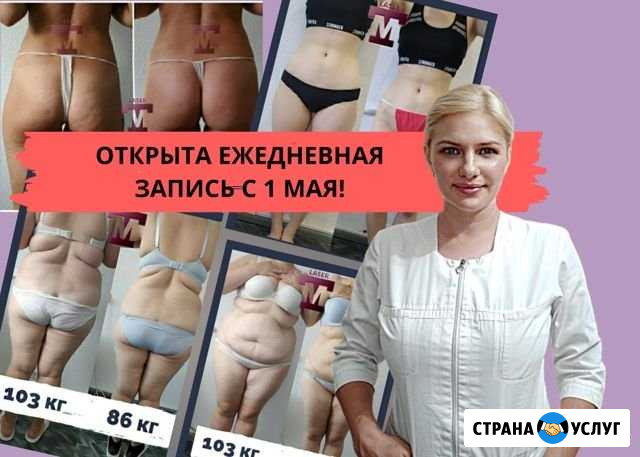 Аппаратный массаж от целлюлита и лишнего веса Симферополь - изображение 1