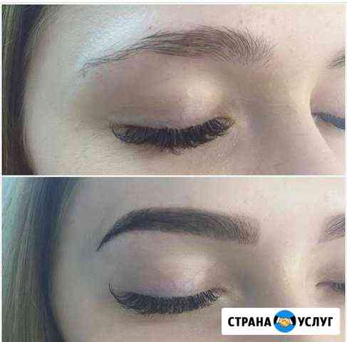 Депеляция Брови Владикавказ