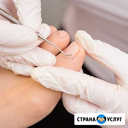 Педикюр лечебный с выездом на дом Великий Новгород - изображение 1