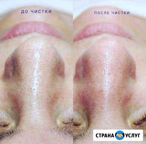 Сертифицированный косметолог с мед.образованием Черняховск