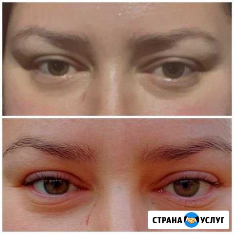 Бровист Нижняя Шиловка - изображение 1