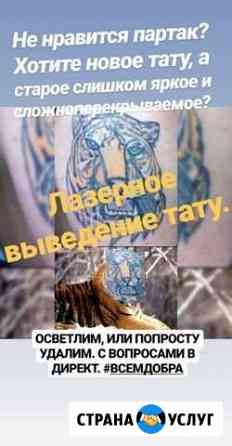 Лазерное удаление тату. Карбоновый пилинг Липецк