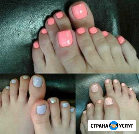 Педикюр Губкин - изображение 1
