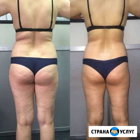 Массаж Курган - изображение 1