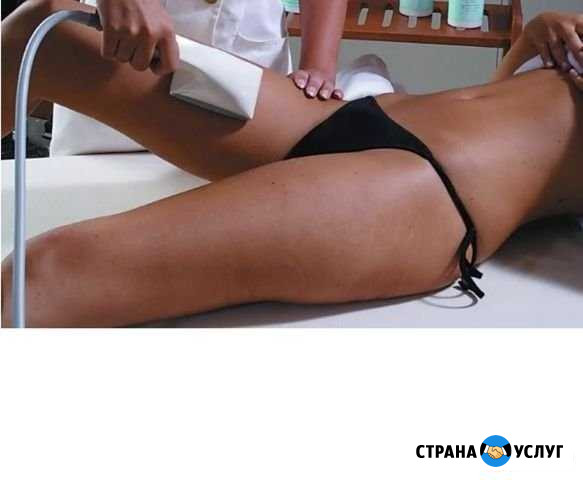 Вакумнороликовый массаж, rf, кавитация Иркутск - изображение 1