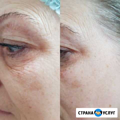 Массаж Железнодорожный - изображение 1
