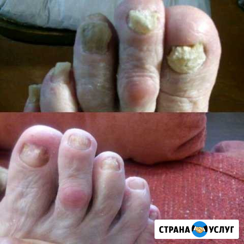 Мастер медицинского маникюра и педикюра с выездом Казань - изображение 1