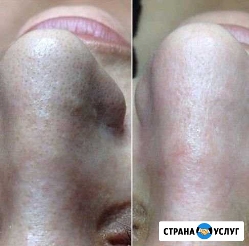 Косметолог Гудермес - изображение 1