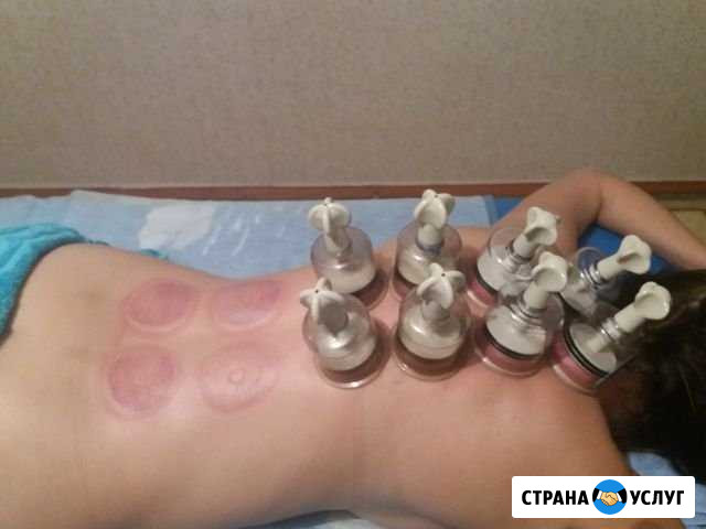 Массаж Ессентуки - изображение 1