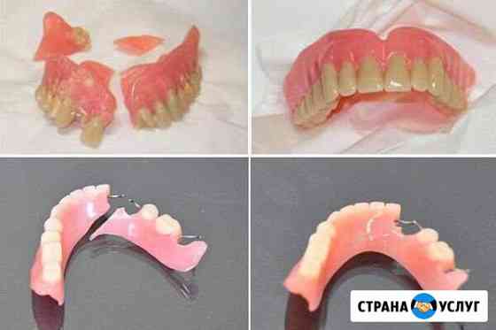 Ремонт зубных протезов Туймазы