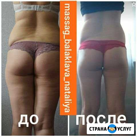 Массаж Севастополь - изображение 1