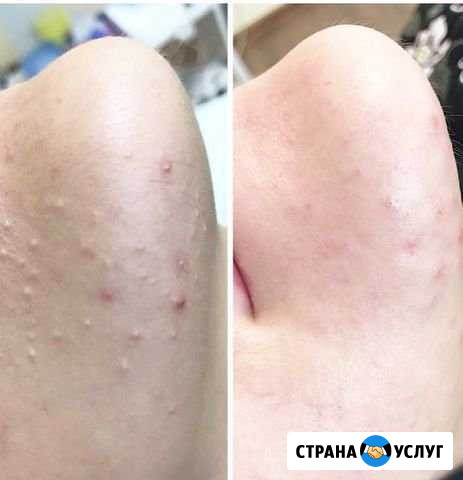Обучение косметолог эстет Грозный - изображение 1