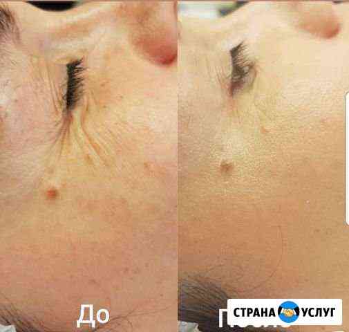 Ищу моделей Люберцы