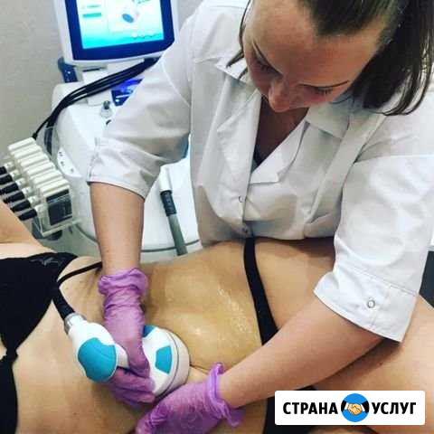LPG массаж, уз кавитация, криосауна, RF лифтинг, л Рыбинск - изображение 1