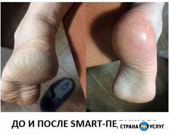Аппаратный маникюр и профи Smart-педикюр Москва