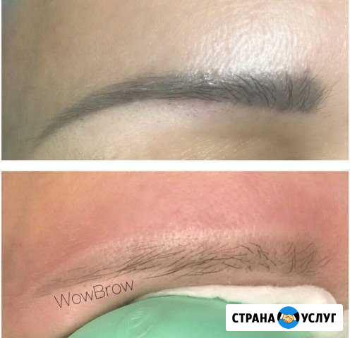 Удаление татуажа Томск - изображение 1