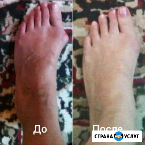 Эстетическая коррекция тела. Массаж Калининград - изображение 1