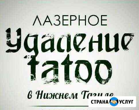 Удаление тату и татуажа Нижний Тагил