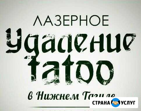Удаление тату и татуажа Нижний Тагил - изображение 1