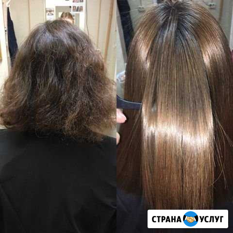 Нанопластика Архангельск - изображение 1
