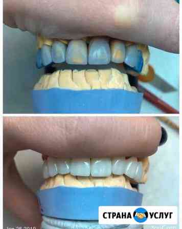 Зубной Техник, все работы делаем Иваново