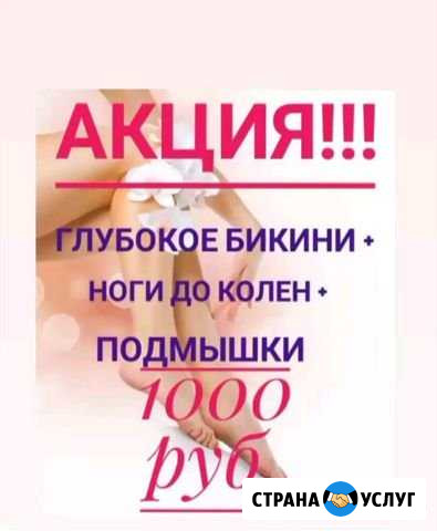 Депиляция Кемерово - изображение 1
