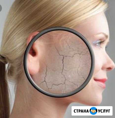 Услуги врача косметолога в жккомарово Тюмень - изображение 1