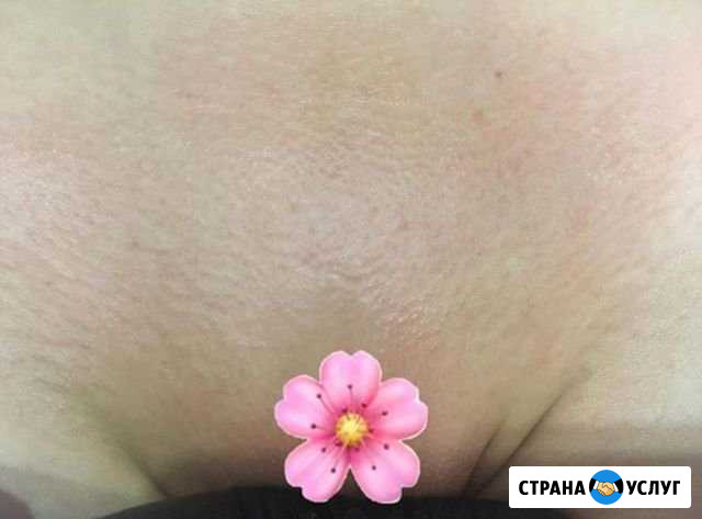 Шугаринг Астрахань - изображение 1