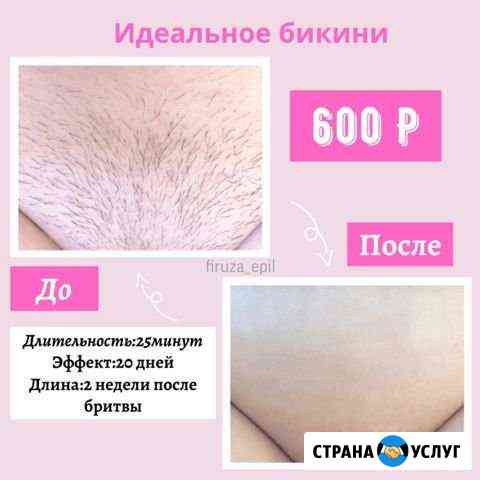 Шугаринг/ваксинг Альметьевск