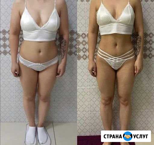 RF лифтинг, кавитация, Миостимуляция, вакуумный ма Кемерово - изображение 1