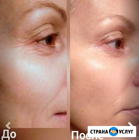 Косметолог (Уход за собой-форма вежливости к себе) Махачкала - изображение 1
