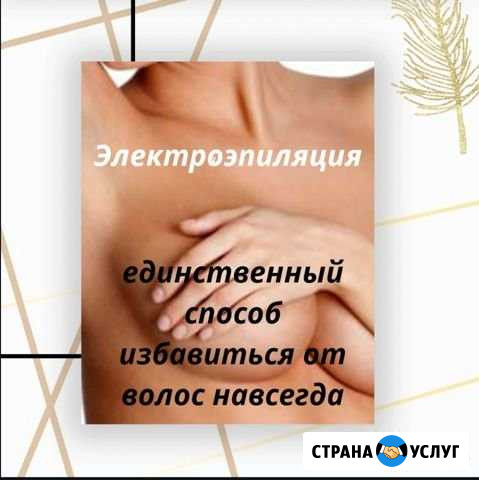 Электроэпиляция Усть-Лабинск - изображение 1