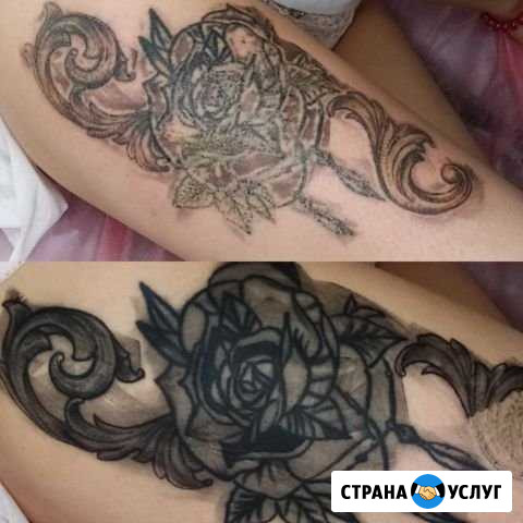 Удаление татуировок и татуажа Тула - изображение 1
