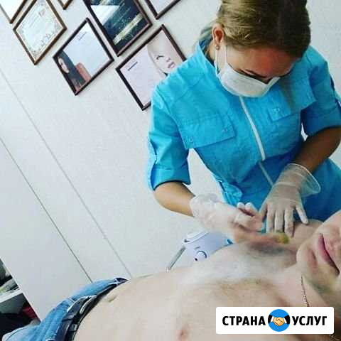 Мужская депиляция Сыктывкар - изображение 1