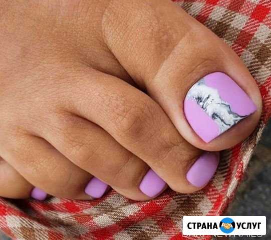 Педикюр Казань - изображение 1