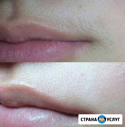 Услуги шугаринга Давыдовка - изображение 1
