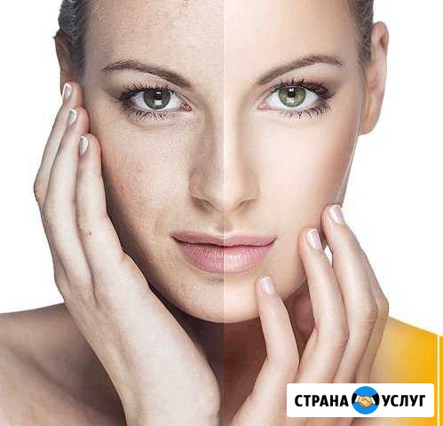 Массажи лица,чистки лица,маски и многое другое Тюмень - изображение 1