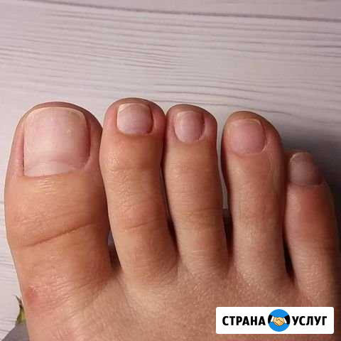 Педикюр, чистка стоп, шеллак Подольск - изображение 1