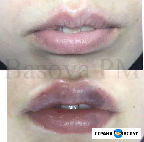 Увеличение губ, перманентный макияж Отрадный - изображение 1