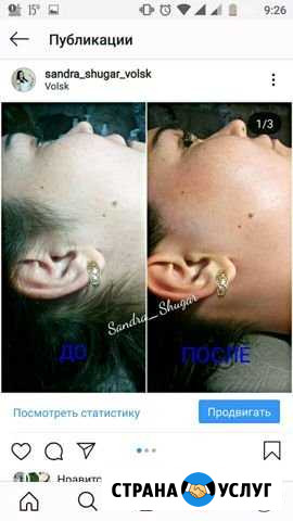 Шугаринг Вольск - изображение 1
