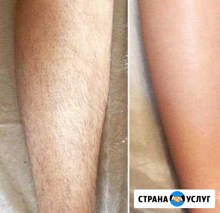 Шугаринг Оренбург - изображение 1