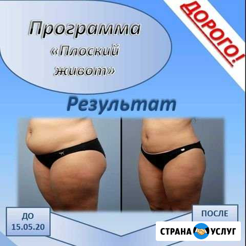 Массаж антицеллюлитный аппаратный,ручной Салават - изображение 1