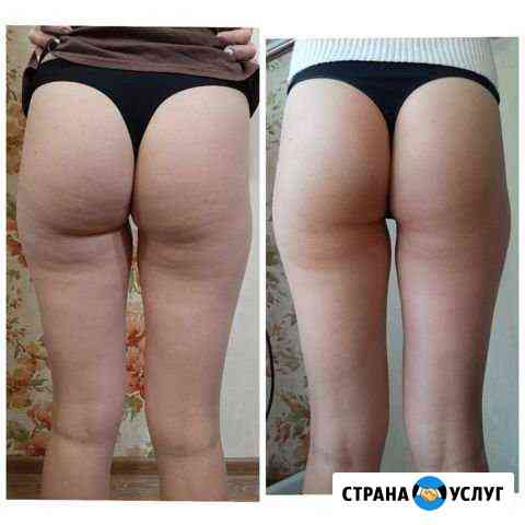 Антицеллюлитный массаж Нижний Новгород