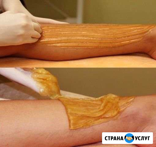 Шугаринг Киров - изображение 1