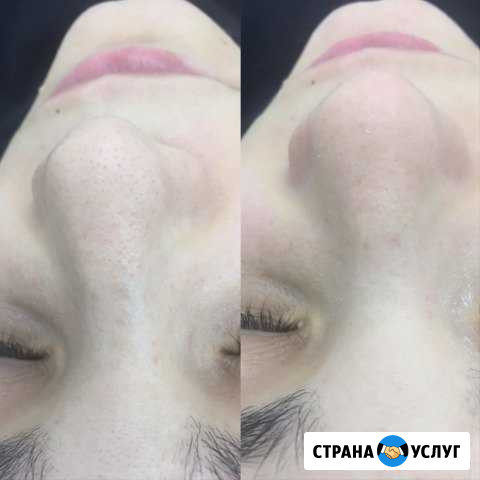 Косметолог Волгоград - изображение 1